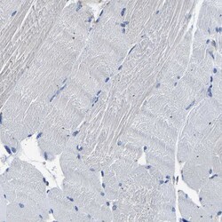 Invitrogen TRK fused gene Polyclonal Antibody 100 &mu;L; Unconjugated:Antibodies,