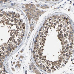 Invitrogen TRK fused gene Polyclonal Antibody 100 &mu;L; Unconjugated:Antibodies,