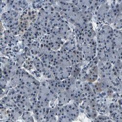 Invitrogen ING2 Polyclonal Antibody 100 &mu;L | Buy Online | Invitrogen&trade; | Fisher Scientific