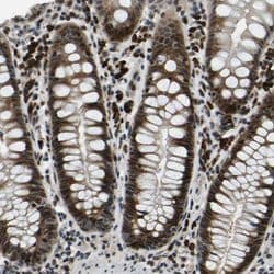 Invitrogen ING2 Polyclonal Antibody 100 &mu;L | Buy Online | Invitrogen&trade; | Fisher Scientific