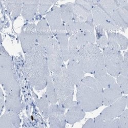 Invitrogen S100P Polyclonal Antibody 100 &mu;L; Unconjugated:Antibodies,