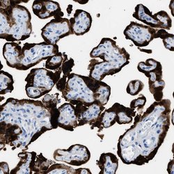 Invitrogen S100P Polyclonal Antibody 100 &mu;L; Unconjugated:Antibodies,