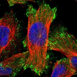 Invitrogen ERC1 Polyclonal Antibody 100 &mu;L; Unconjugated:Antibodies,