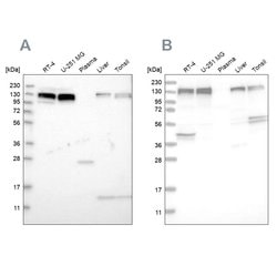 Invitrogen ERC1 Polyclonal Antibody 100 &mu;L; Unconjugated:Antibodies,