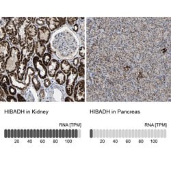Invitrogen HIBADH Polyclonal Antibody 100 &mu;L; Unconjugated:Antibodies,