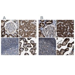 Invitrogen HIBADH Polyclonal Antibody 100 &mu;L; Unconjugated:Antibodies,