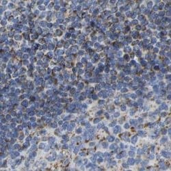 Invitrogen HIBADH Polyclonal Antibody 100 &mu;L; Unconjugated:Antibodies,