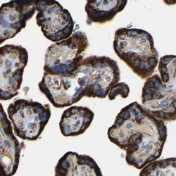 Invitrogen HIBADH Polyclonal Antibody 100 &mu;L; Unconjugated:Antibodies,