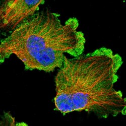 Invitrogen ERC1 Polyclonal Antibody 100 &mu;L; Unconjugated:Antibodies,