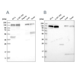 Invitrogen ERC1 Polyclonal Antibody 100 &mu;L; Unconjugated:Antibodies,