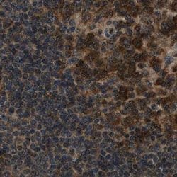 Invitrogen NUDCD3 Polyclonal Antibody 100 &mu;L; Unconjugated:Antibodies,