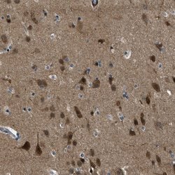Invitrogen NUDCD3 Polyclonal Antibody 100 &mu;L; Unconjugated:Antibodies,