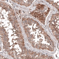 Invitrogen PER3 Polyclonal Antibody 100 &mu;L; Unconjugated:Antibodies,