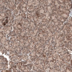 Invitrogen PER3 Polyclonal Antibody 100 &mu;L; Unconjugated:Antibodies,