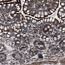 Invitrogen AGPAT2 Polyclonal Antibody 100 &mu;L; Unconjugated:Antibodies,
