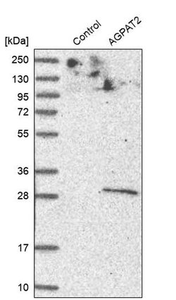 Invitrogen AGPAT2 Polyclonal Antibody 100 &mu;L; Unconjugated:Antibodies,
