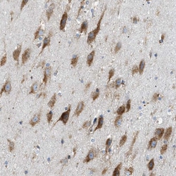 Invitrogen LMBRD1 Polyclonal Antibody 100 &mu;L; Unconjugated:Antibodies,