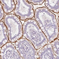 Invitrogen SLC28A1 Polyclonal Antibody 100 &mu;L; Unconjugated:Antibodies,