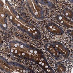 Invitrogen ABCG8 Polyclonal Antibody 100 &mu;L; Unconjugated:Antibodies,