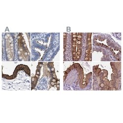 Invitrogen Annexin A13 Polyclonal Antibody 100 &mu;L; Unconjugated:Antibodies,
