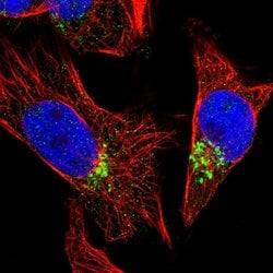Invitrogen FAM18B Polyclonal Antibody 100 &mu;L | Buy Online | Invitrogen&trade; | Fisher Scientific