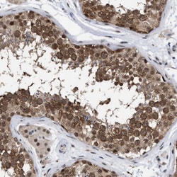 Invitrogen UPF1 Polyclonal Antibody 100 &mu;L; Unconjugated:Antibodies,