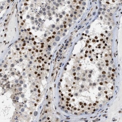 Invitrogen MIER1 Polyclonal Antibody 100 &mu;L; Unconjugated:Antibodies,