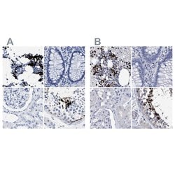 Invitrogen HEMGN Polyclonal Antibody 100 &mu;L; Unconjugated:Antibodies,