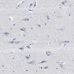Invitrogen HEMGN Polyclonal Antibody 100 &mu;L; Unconjugated:Antibodies,