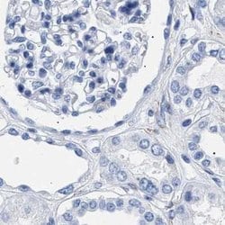 Invitrogen HEMGN Polyclonal Antibody 100 &mu;L; Unconjugated:Antibodies,