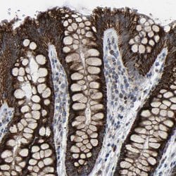 Invitrogen CANT1 Polyclonal Antibody 100 &mu;L; Unconjugated:Antibodies,