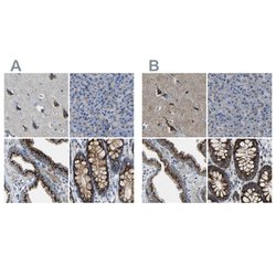 Invitrogen CANT1 Polyclonal Antibody 100 μL; Unconjugated:Antibodies,