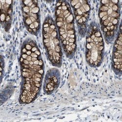 Invitrogen CANT1 Polyclonal Antibody 100 μL; Unconjugated:Antibodies,