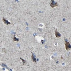 Invitrogen CANT1 Polyclonal Antibody 100 μL; Unconjugated:Antibodies,
