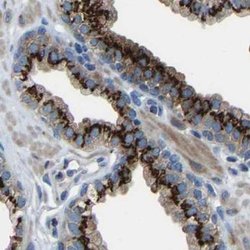 Invitrogen CANT1 Polyclonal Antibody 100 μL; Unconjugated:Antibodies,