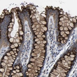 Invitrogen CANT1 Polyclonal Antibody 100 μL; Unconjugated:Antibodies,