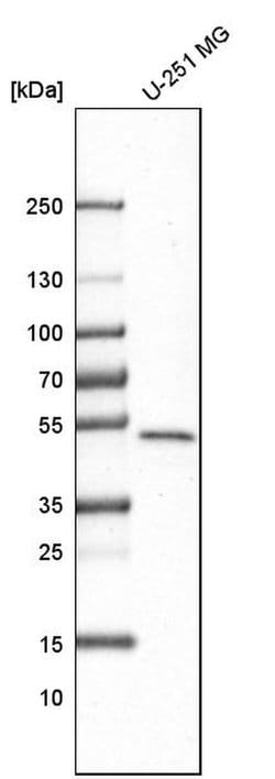 Invitrogen GABPB1 Polyclonal Antibody 100 &mu;L; Unconjugated:Antibodies,