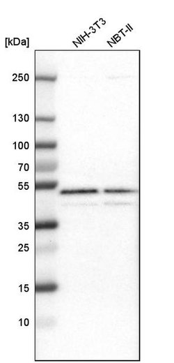 Invitrogen GABPB1 Polyclonal Antibody 100 &mu;L; Unconjugated:Antibodies,