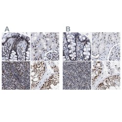 Invitrogen TPR Polyclonal Antibody 100 &mu;L; Unconjugated:Antibodies,