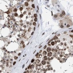 Invitrogen TPR Polyclonal Antibody 100 &mu;L; Unconjugated:Antibodies,