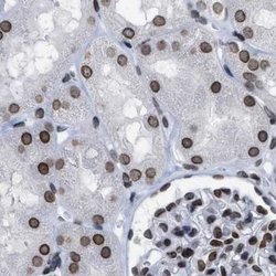 Invitrogen TPR Polyclonal Antibody 100 &mu;L; Unconjugated:Antibodies,
