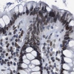 Invitrogen TPR Polyclonal Antibody 100 &mu;L; Unconjugated:Antibodies,