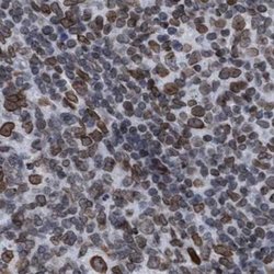 Invitrogen TPR Polyclonal Antibody 100 &mu;L; Unconjugated:Antibodies,