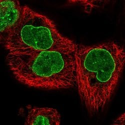 Invitrogen TPR Polyclonal Antibody 100 &mu;L; Unconjugated:Antibodies,