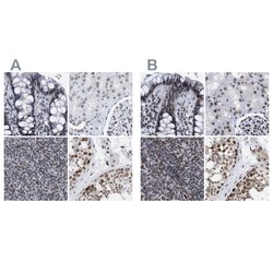 Invitrogen TPR Polyclonal Antibody 100 &mu;L; Unconjugated:Antibodies,