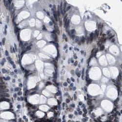 Invitrogen TPR Polyclonal Antibody 100 &mu;L; Unconjugated:Antibodies,