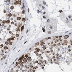 Invitrogen TPR Polyclonal Antibody 100 &mu;L; Unconjugated:Antibodies,