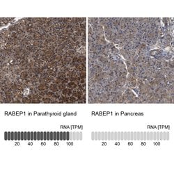 Invitrogen RABEP1 Polyclonal Antibody 100 &mu;L; Unconjugated:Antibodies,