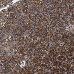 Invitrogen RABEP1 Polyclonal Antibody 100 &mu;L; Unconjugated:Antibodies,