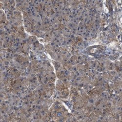 Invitrogen RABEP1 Polyclonal Antibody 100 &mu;L; Unconjugated:Antibodies,